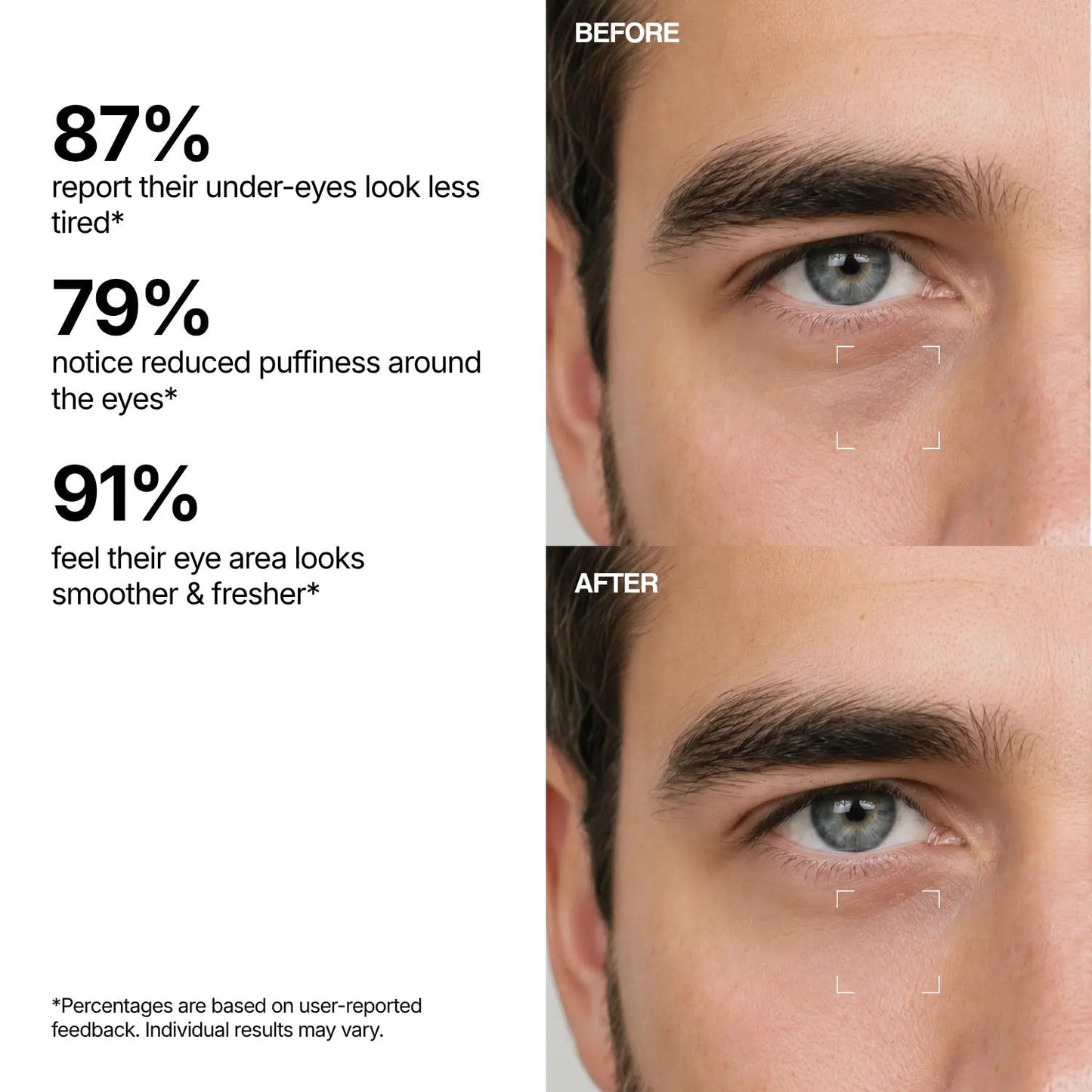 GlowEyes™ – Augenpflege-Serum für einen strahlenden, frischen Blick