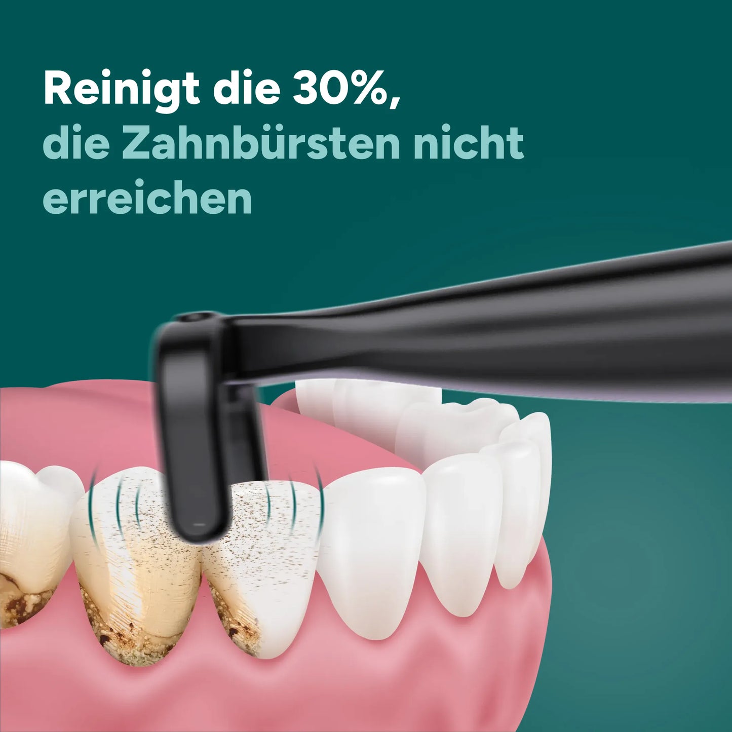Elektrische Zahnseide für gründlich saubere Zähne – mühelos