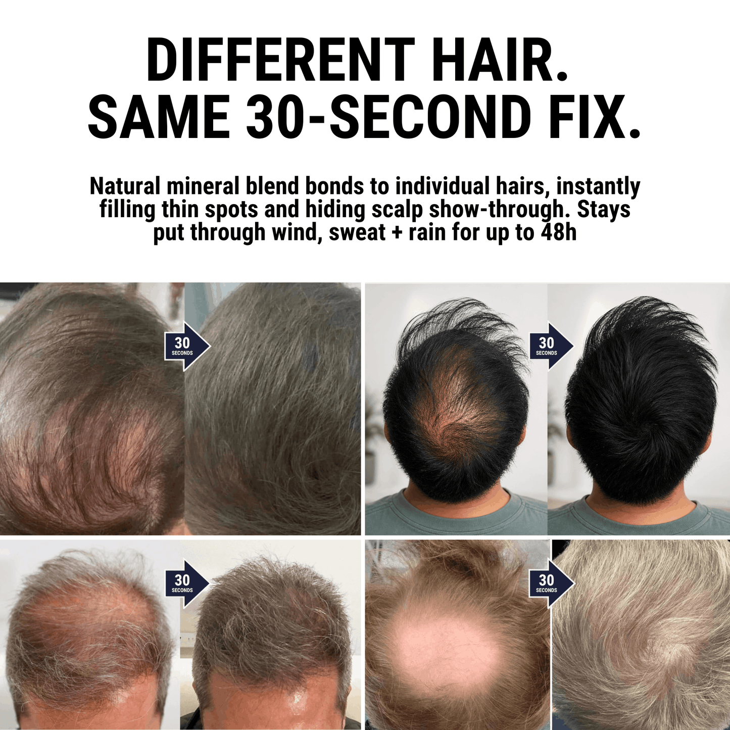 Densiq PRO – Auffüller für mehr Haardichte