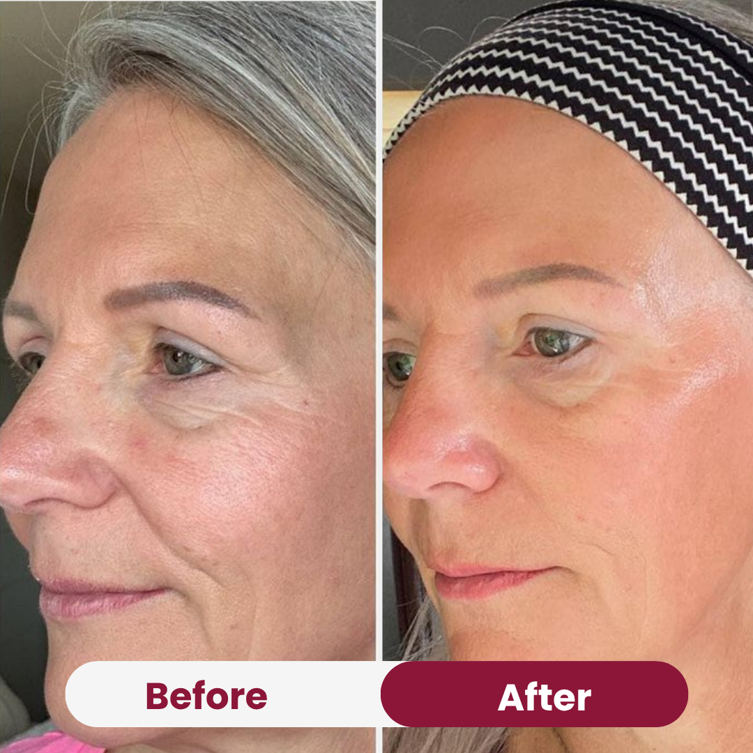 Bio-Kollagen-Maske