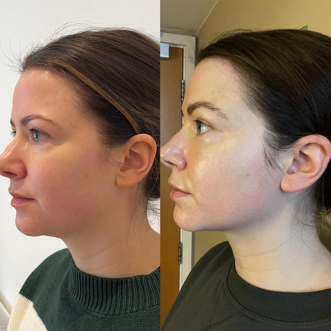Nature's Roods | Lymphdrainage-Wellness-Tropfen