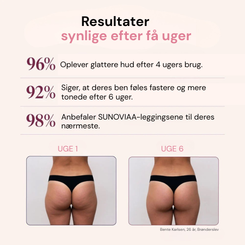 Sculptiva™ – 3D Anti-Cellulite-Leggings für eine glatte Silhouette
