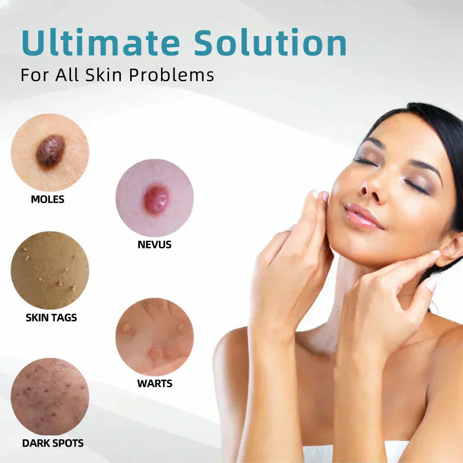 DermaLase™ | All-in-One CO₂ Laser Eraser Pen | Entfernt Muttermale, Warzen, Hautfehler &amp; Pigmentflecken