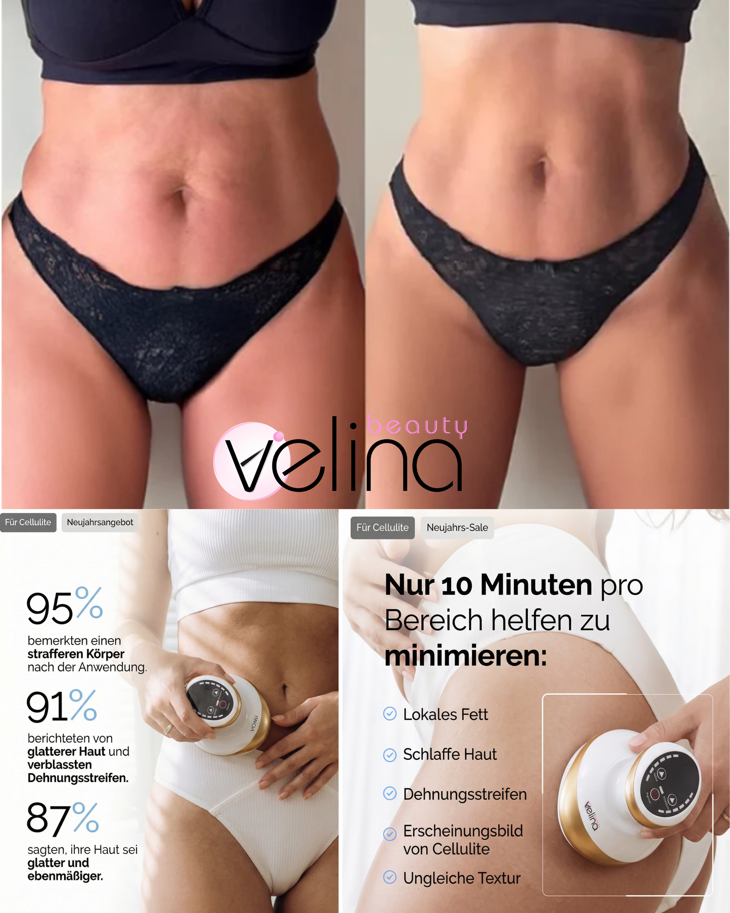 BodySculpt™ | Sculpt Gerät für glattere und straffere Haut