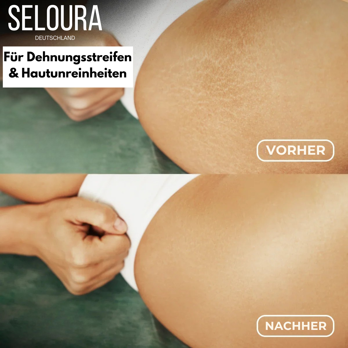 BodyLuxe™ Pflegecreme für straffere, geschmeidigere Haut