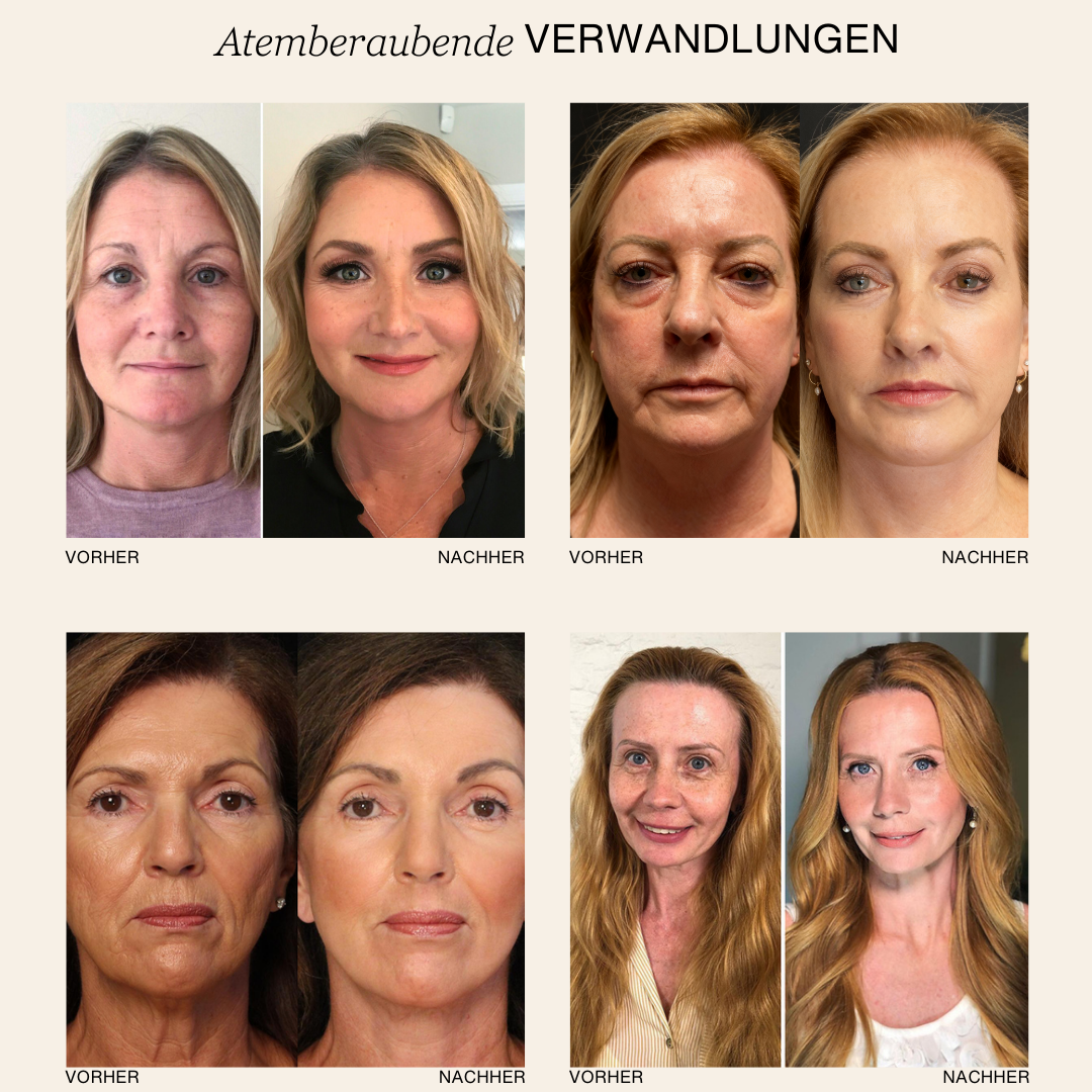 Dermaluxe™ | Color Adaptive Foundation mit natürlichem Glow