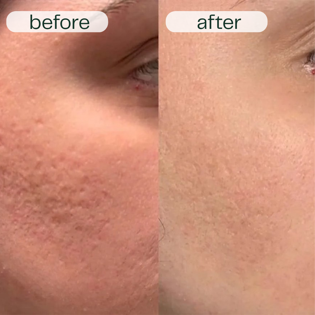 GlowNexa™ – Intensives Nachtpflege-Serum Duo für glatte & gepflegte Haut