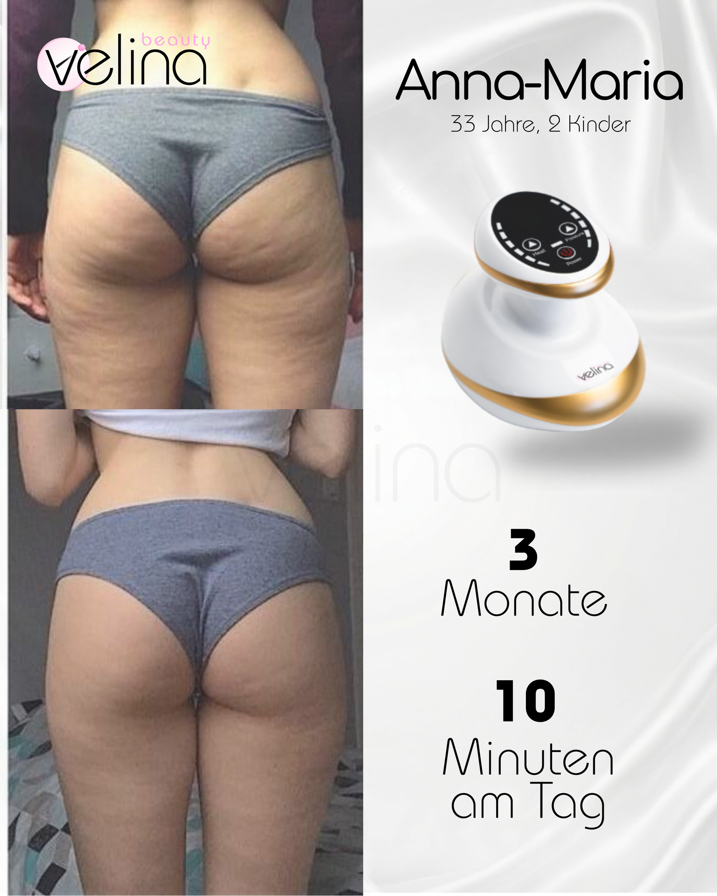 BodySculpt™ | Sculpt Gerät für glattere und straffere Haut