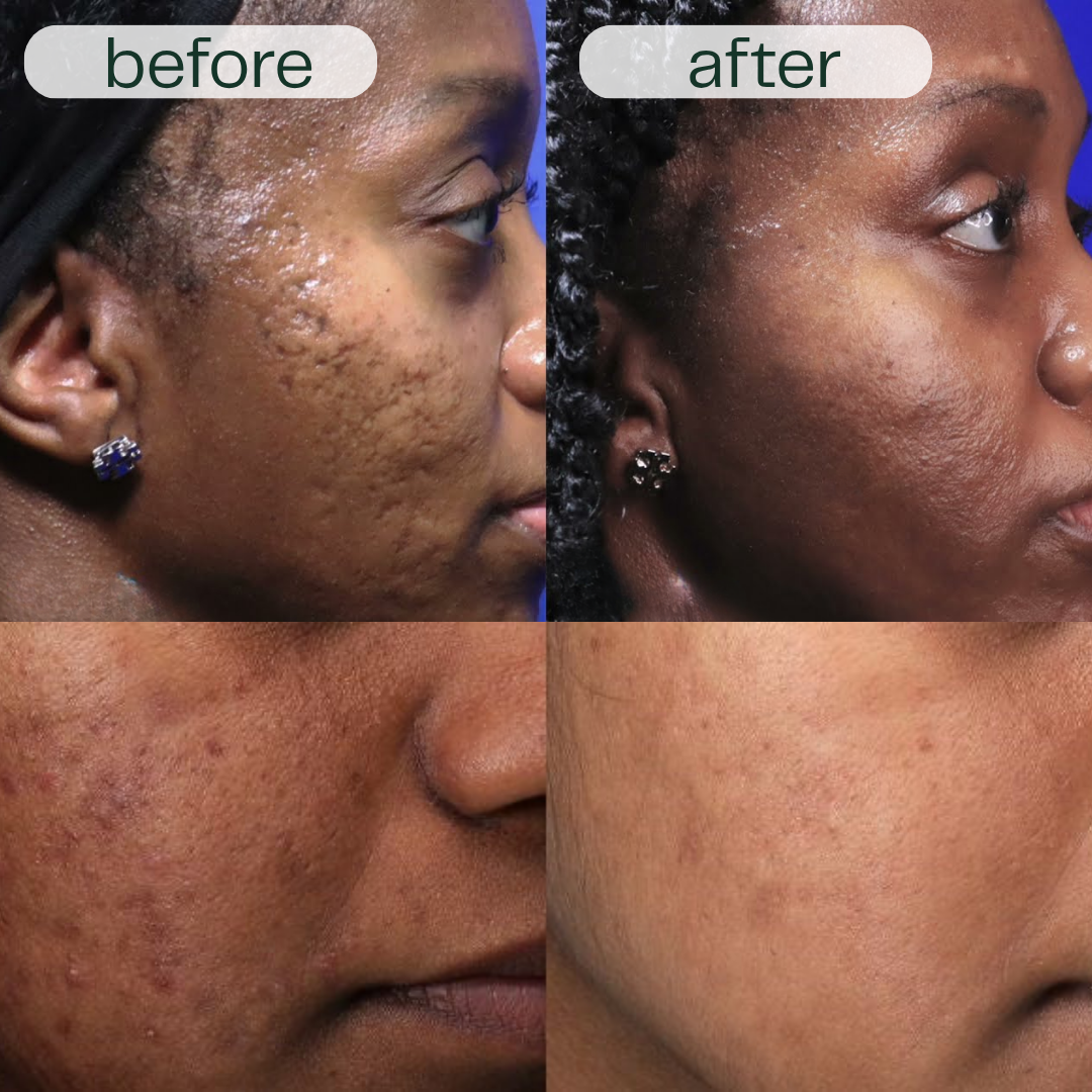 GlowNexa™ – Intensives Nachtpflege-Serum Duo für glatte & gepflegte Haut