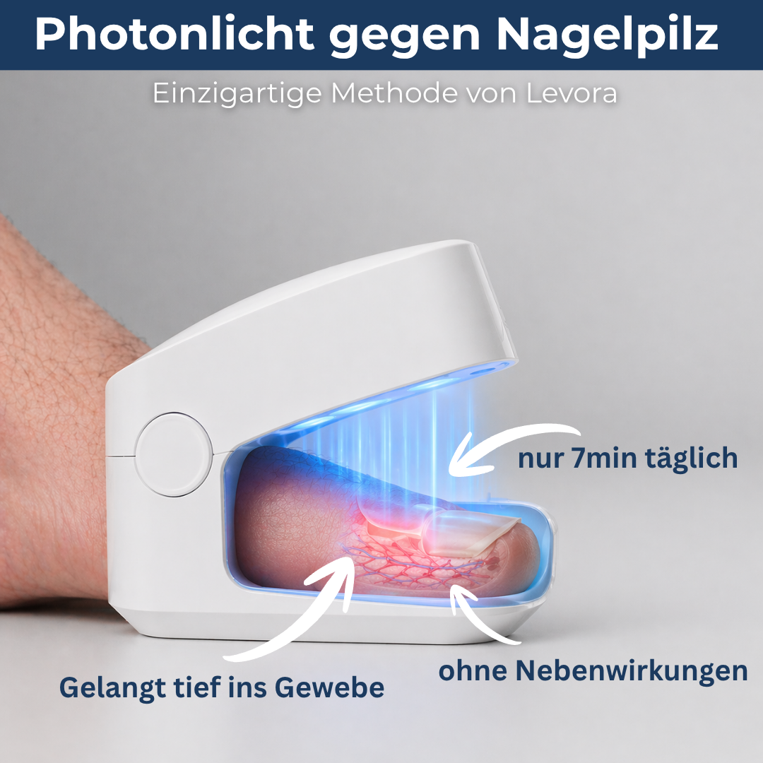 Levora | MedNail gegen jahrelangen Nagelpilz