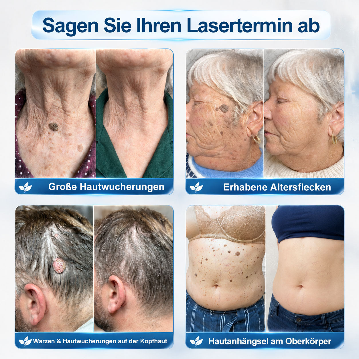 SpotLuxe™ – Sanfte Hautpflege für ein ebenmäßigeres Erscheinungsbild