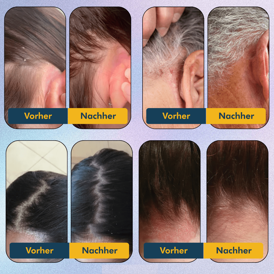 Scalpora™ – Pflegendes Kopfhautöl für eine gesunde Kopfhaut