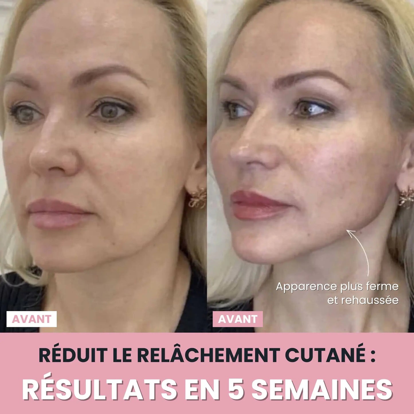 LenaSilk™: Sculpteur Gesichts-LED 7 en 1