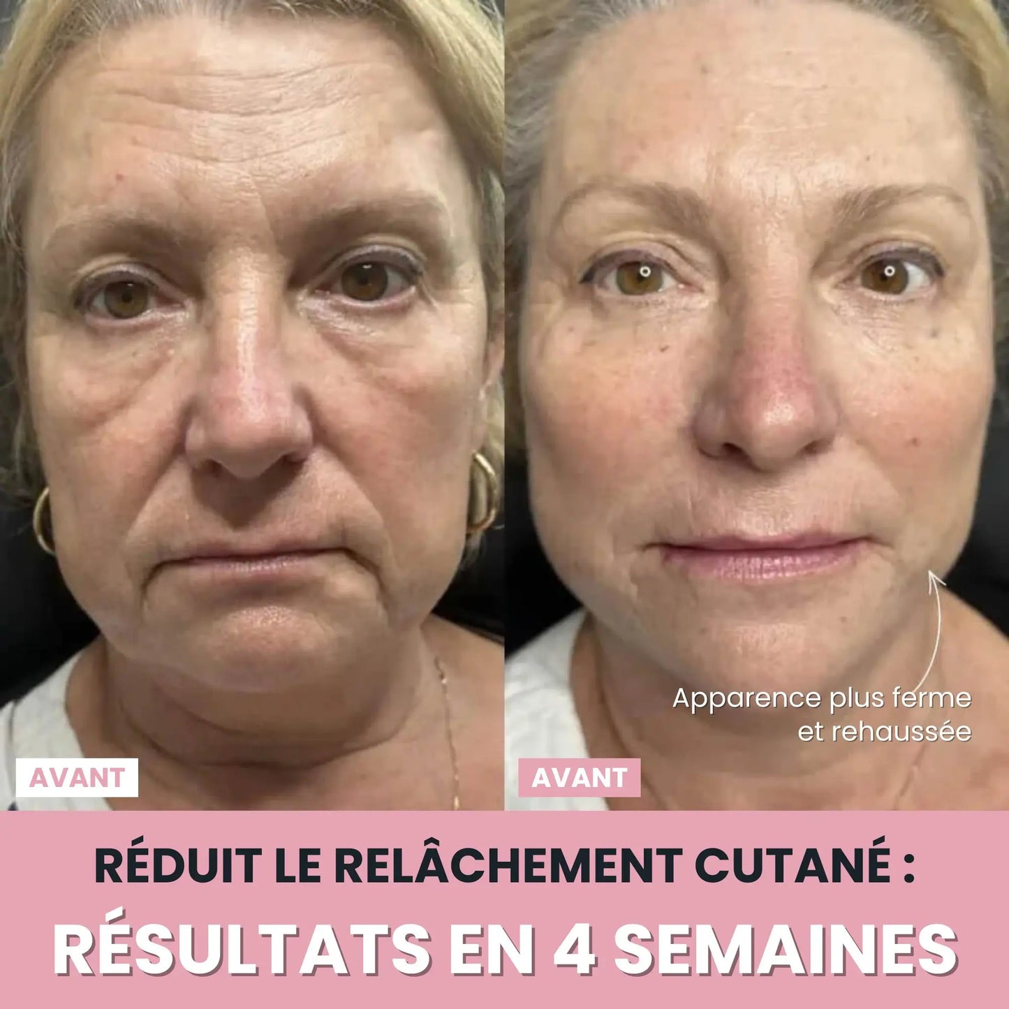LenaSilk™: Sculpteur Gesichts-LED 7 en 1