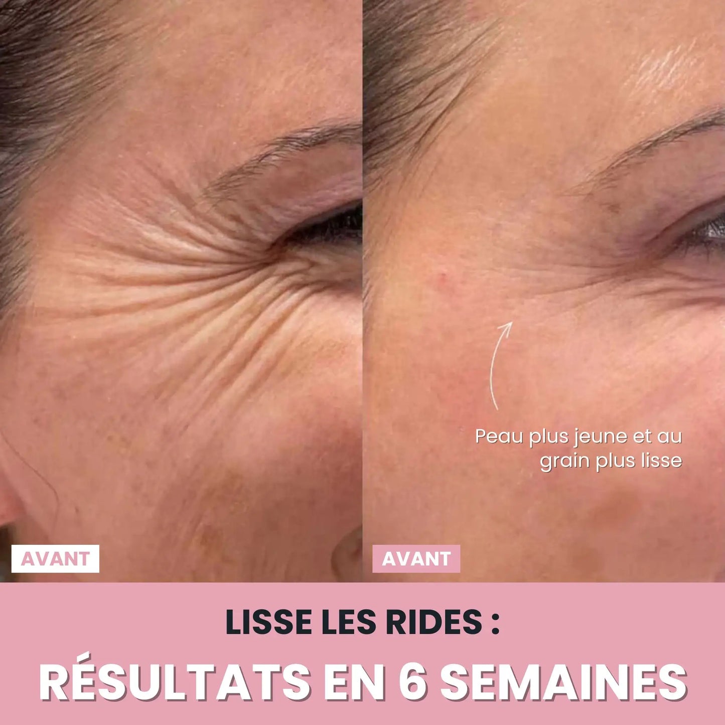 LenaSilk™: Sculpteur Gesichts-LED 7 en 1