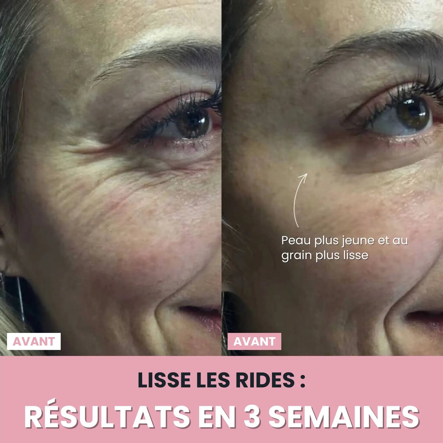 LenaSilk™: Sculpteur Gesichts-LED 7 en 1