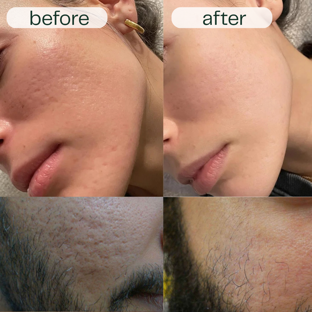GlowNexa™ – Intensives Nachtpflege-Serum Duo für glatte & gepflegte Haut