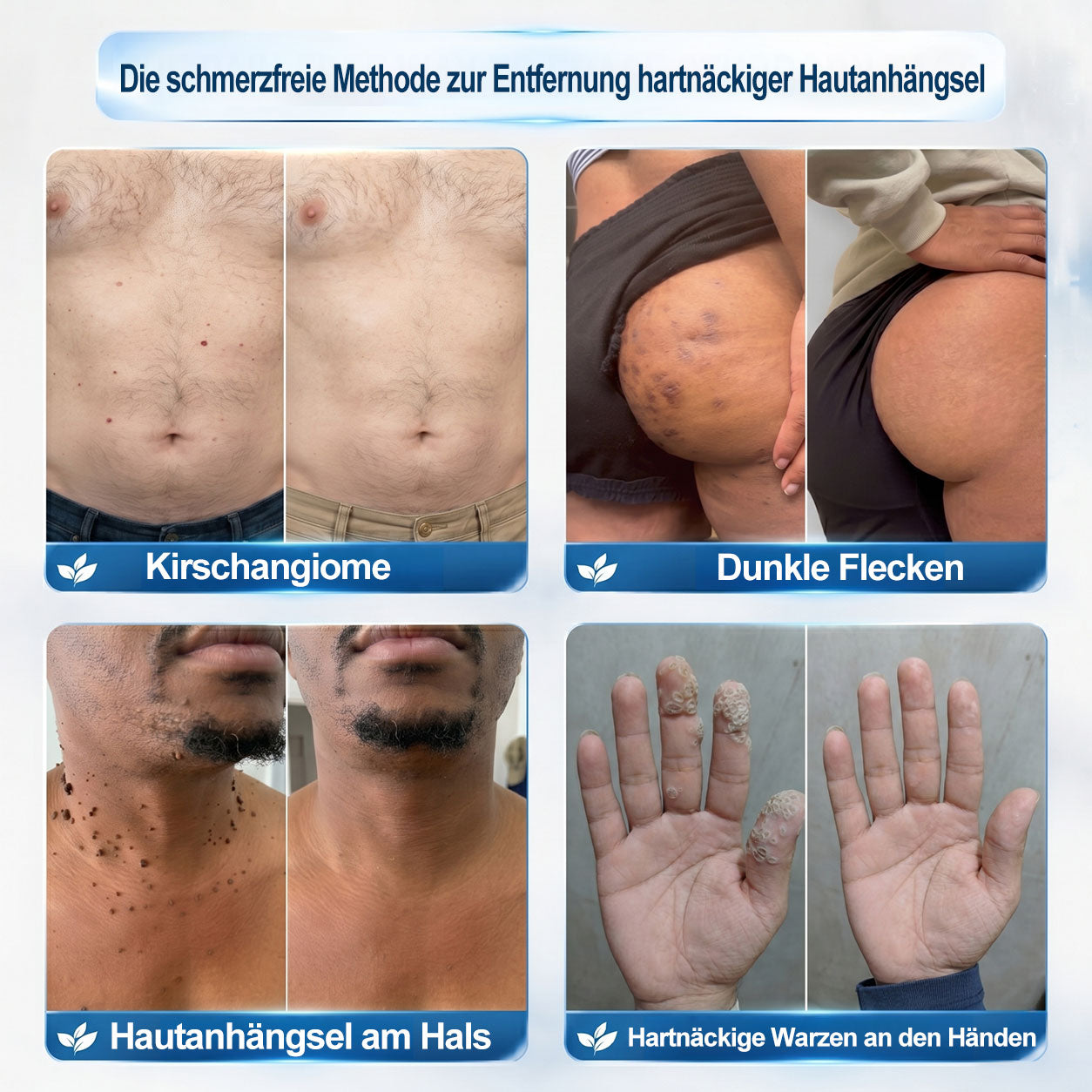 SpotLuxe™ – Sanfte Hautpflege für ein ebenmäßigeres Erscheinungsbild