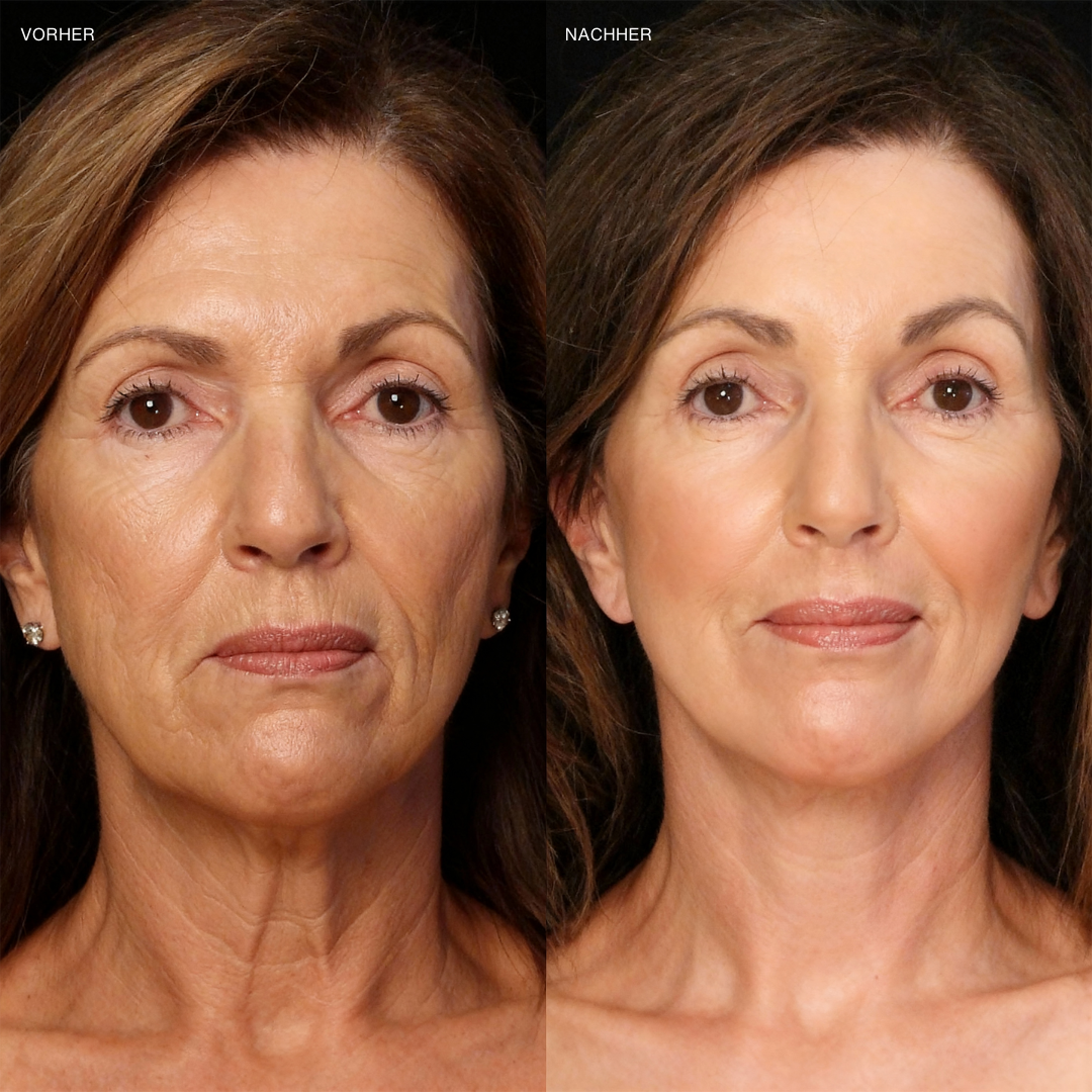 Dermaluxe™ | Color Adaptive Foundation mit natürlichem Glow