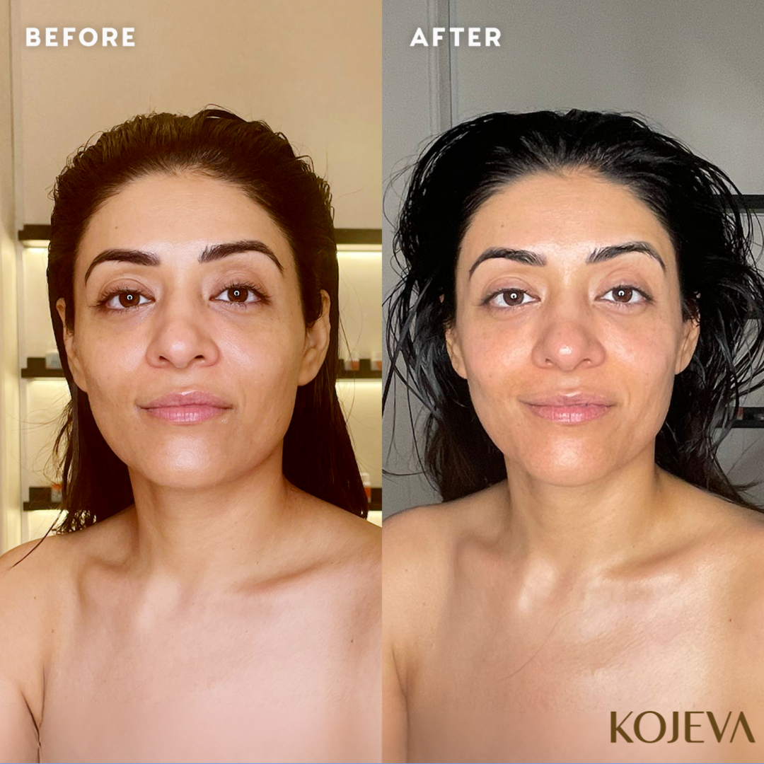 Kojeva Lymphdrainage-Gesichtsbürste