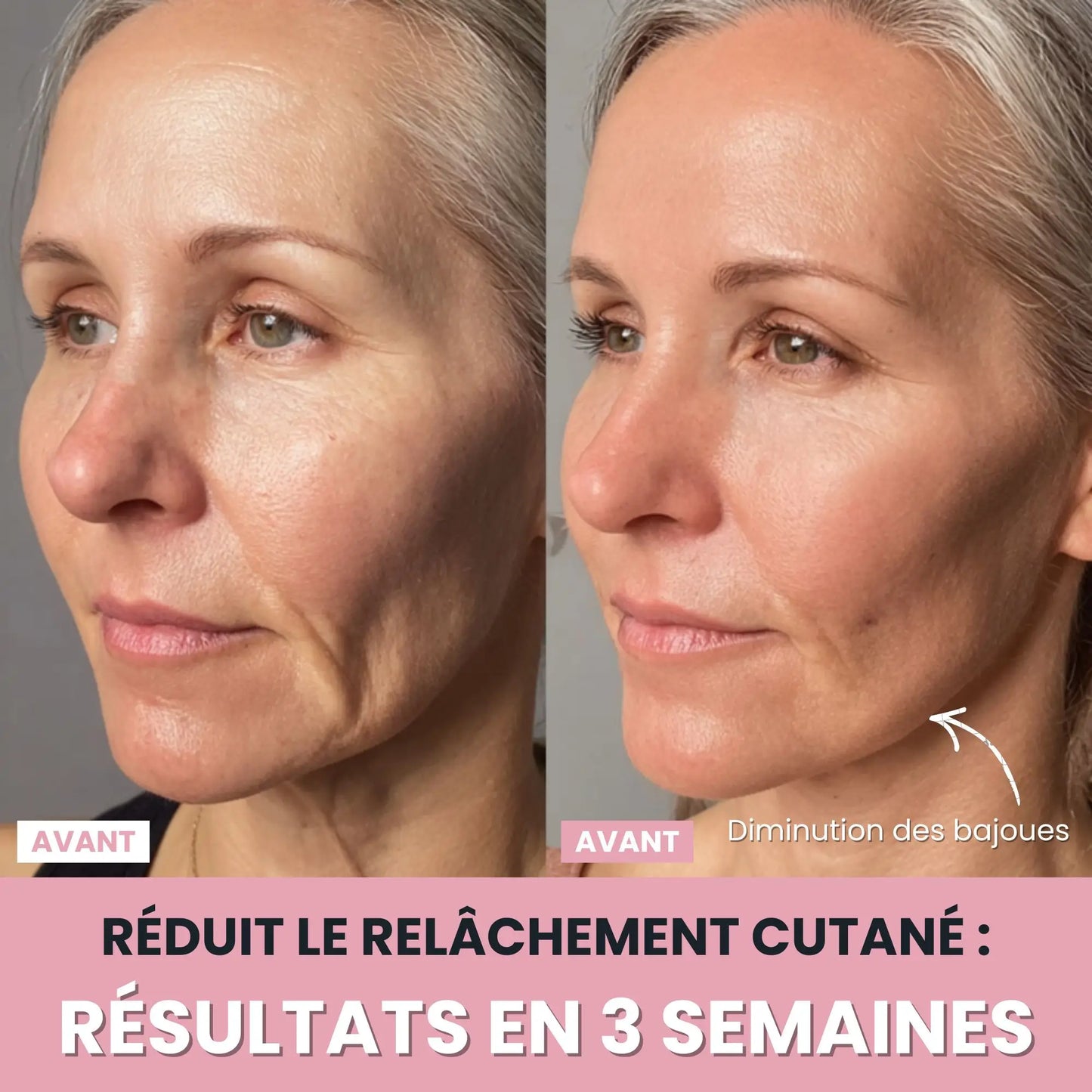 LenaSilk™: Sculpteur Gesichts-LED 7 en 1
