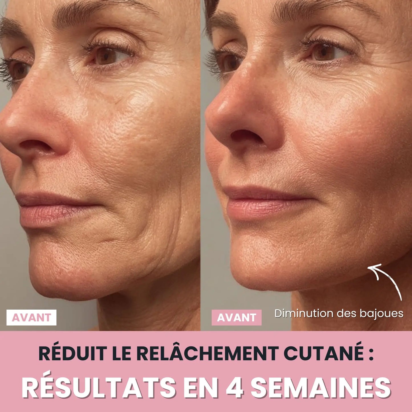 LenaSilk™: Sculpteur Gesichts-LED 7 en 1