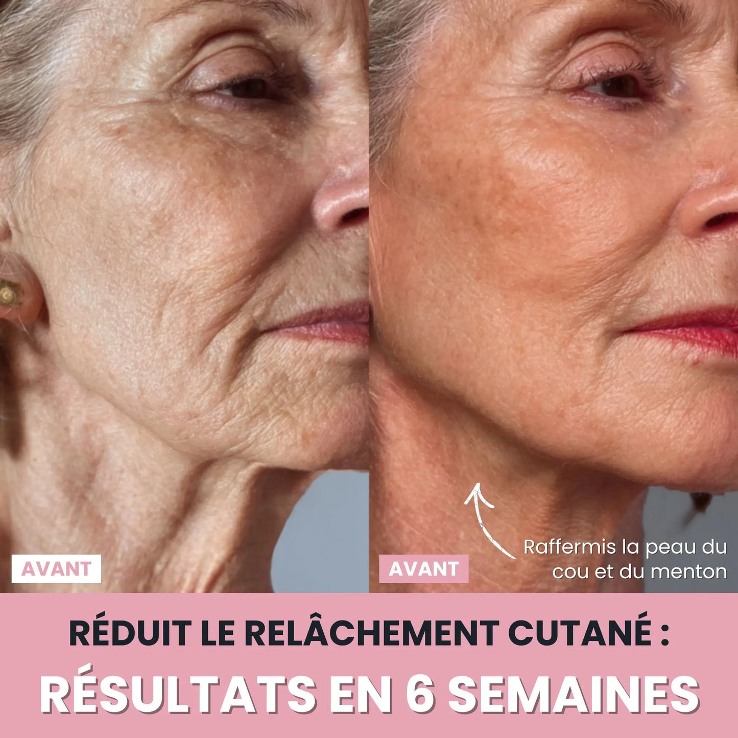 LenaSilk™: Sculpteur Gesichts-LED 7 en 1