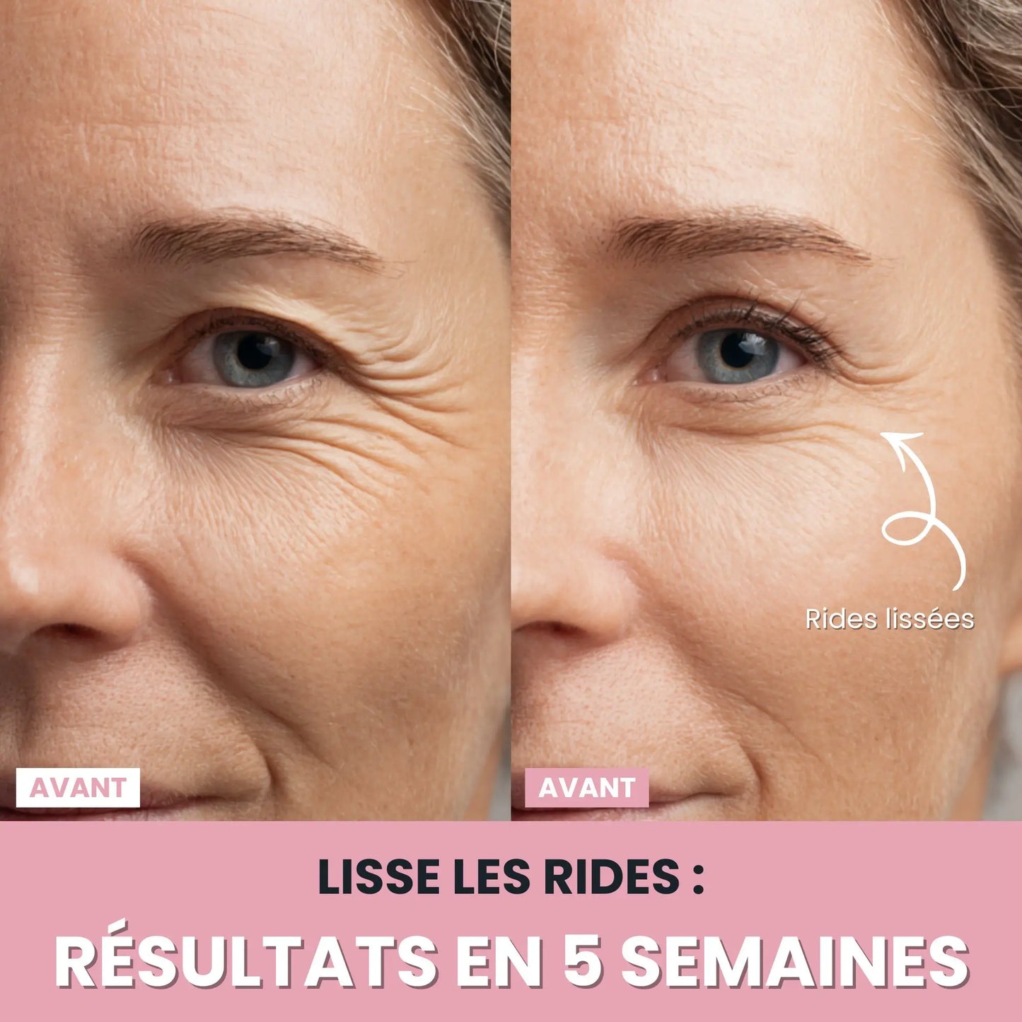 LenaSilk™: Sculpteur Gesichts-LED 7 en 1