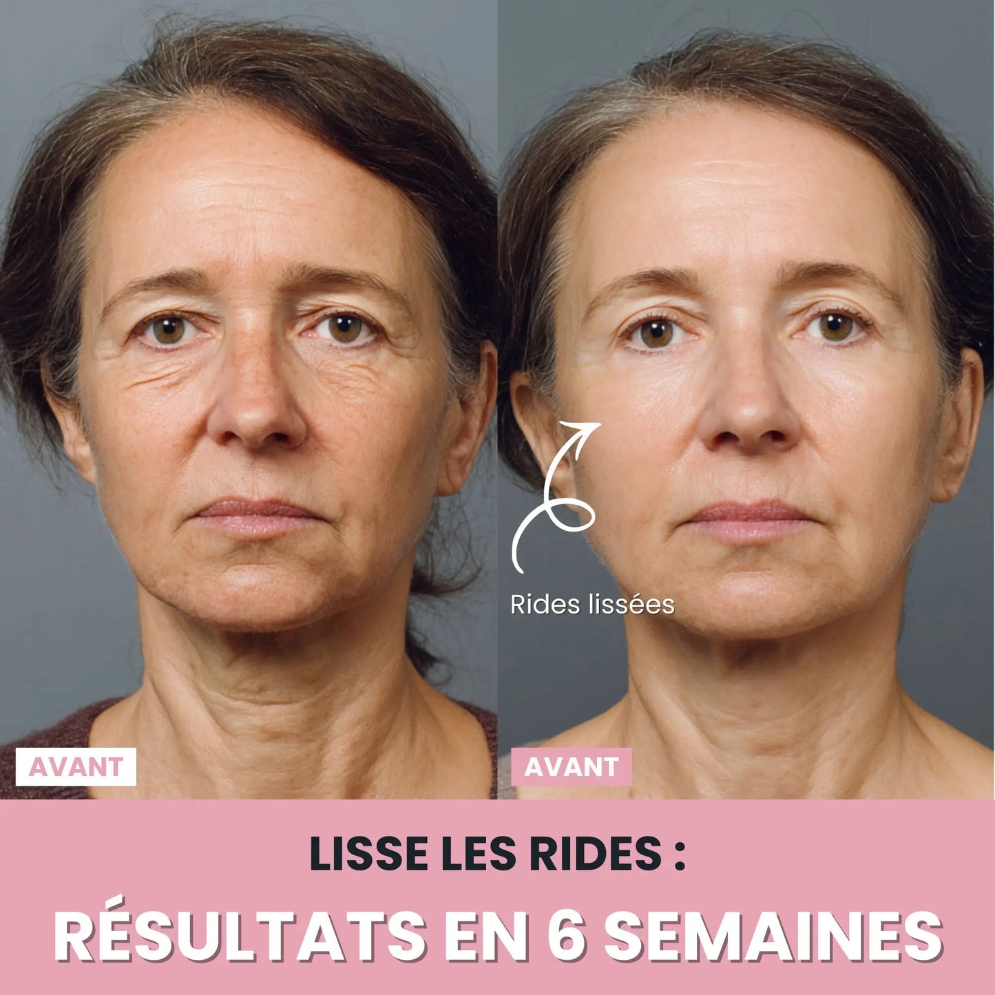 LenaSilk™: Sculpteur Gesichts-LED 7 en 1