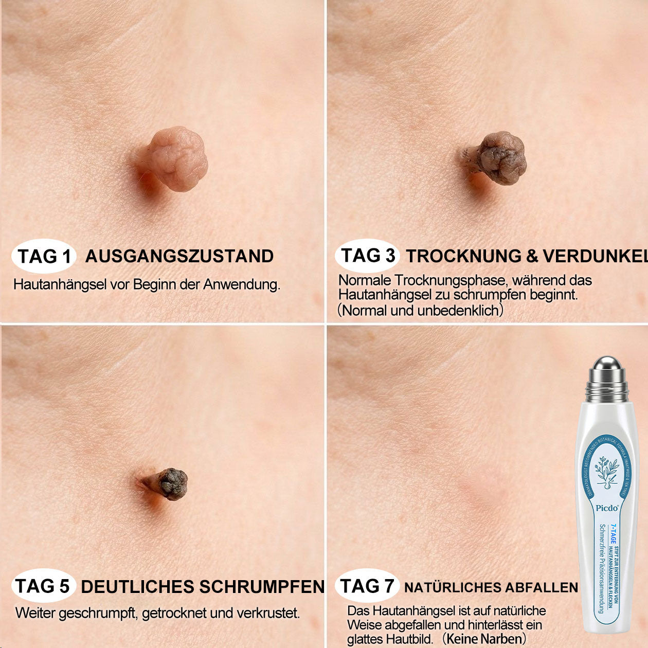 SpotLuxe™ – Sanfte Hautpflege für ein ebenmäßigeres Erscheinungsbild