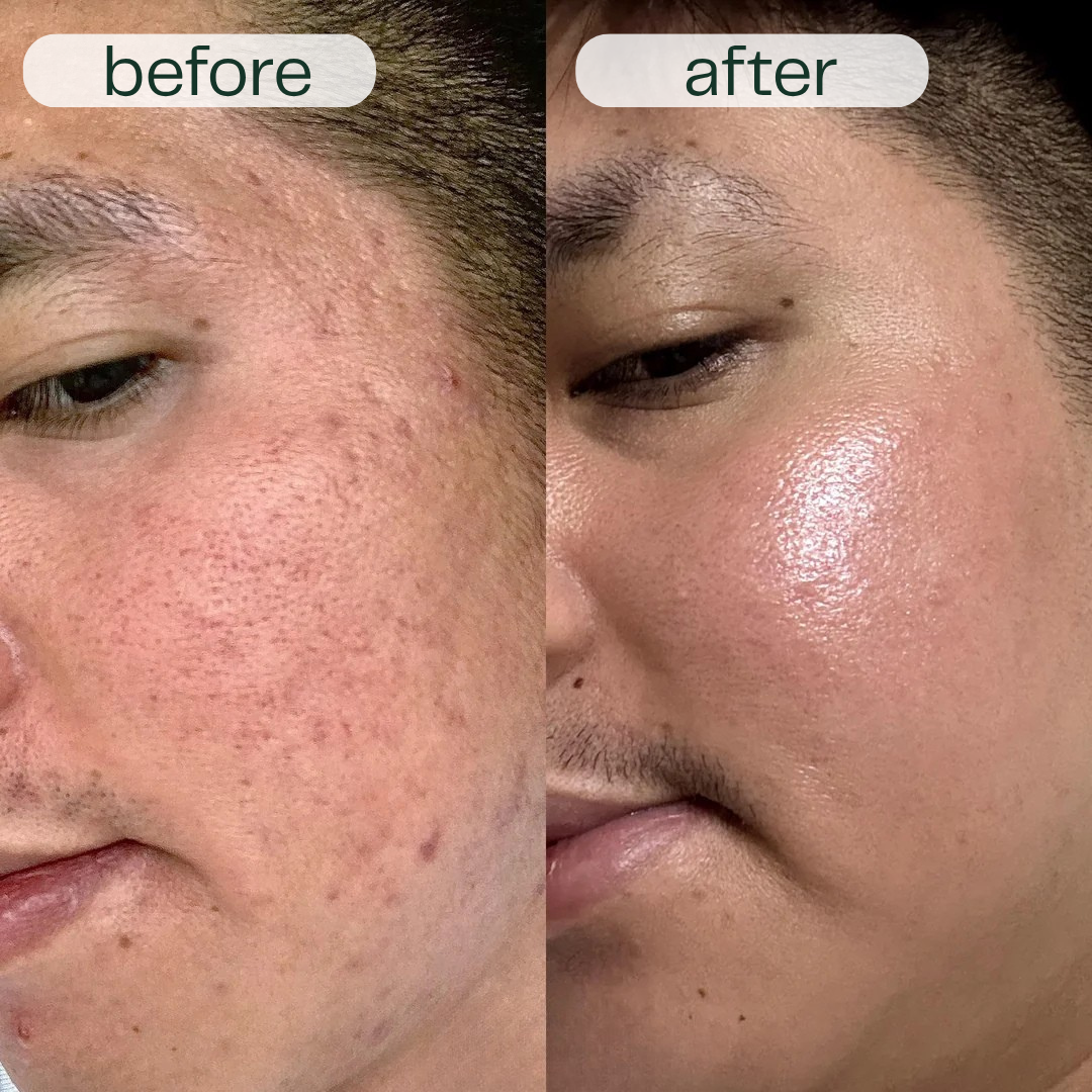 GlowNexa™ – Intensives Nachtpflege-Serum Duo für glatte & gepflegte Haut