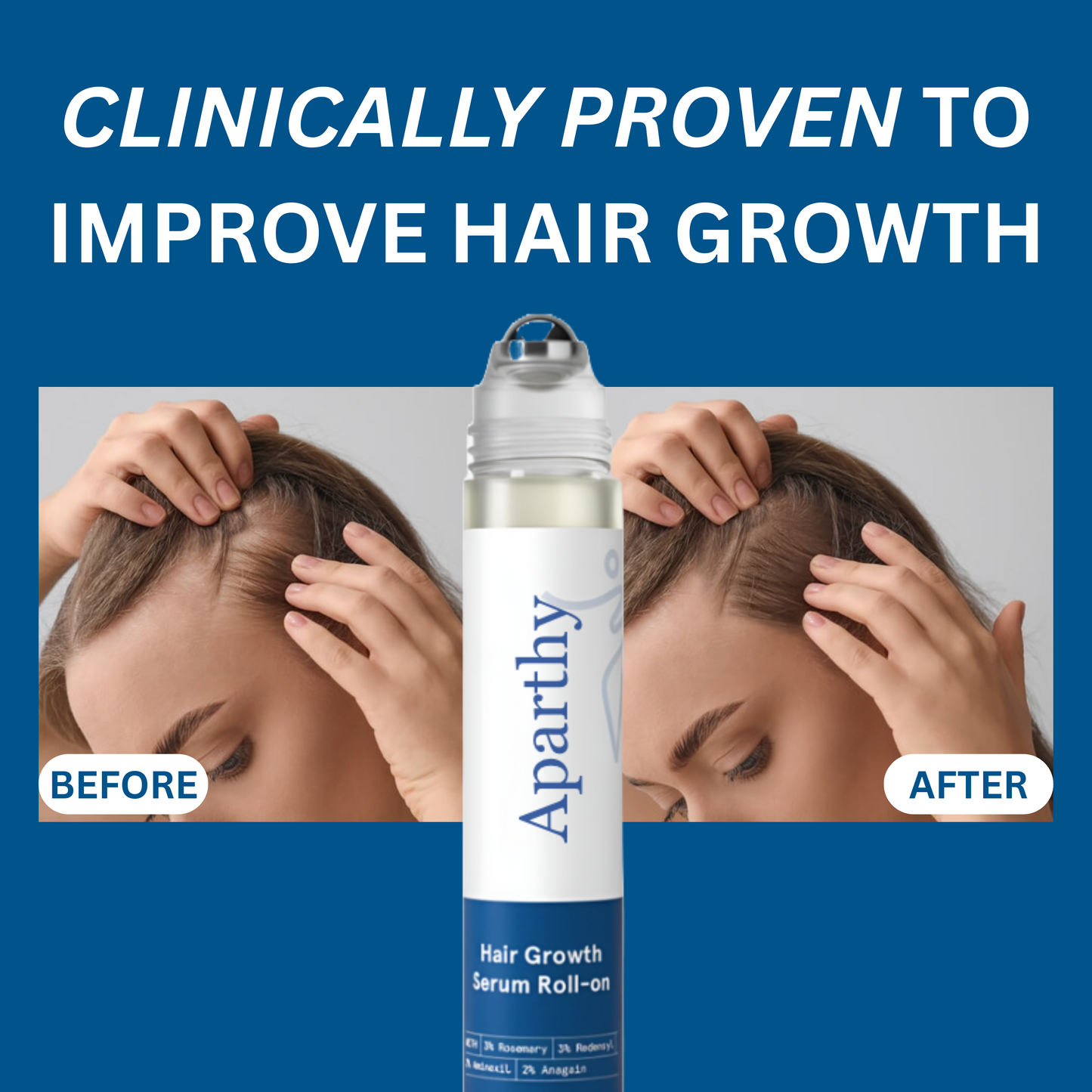Aparthy | Haarwuchs-Roll-on-Serum