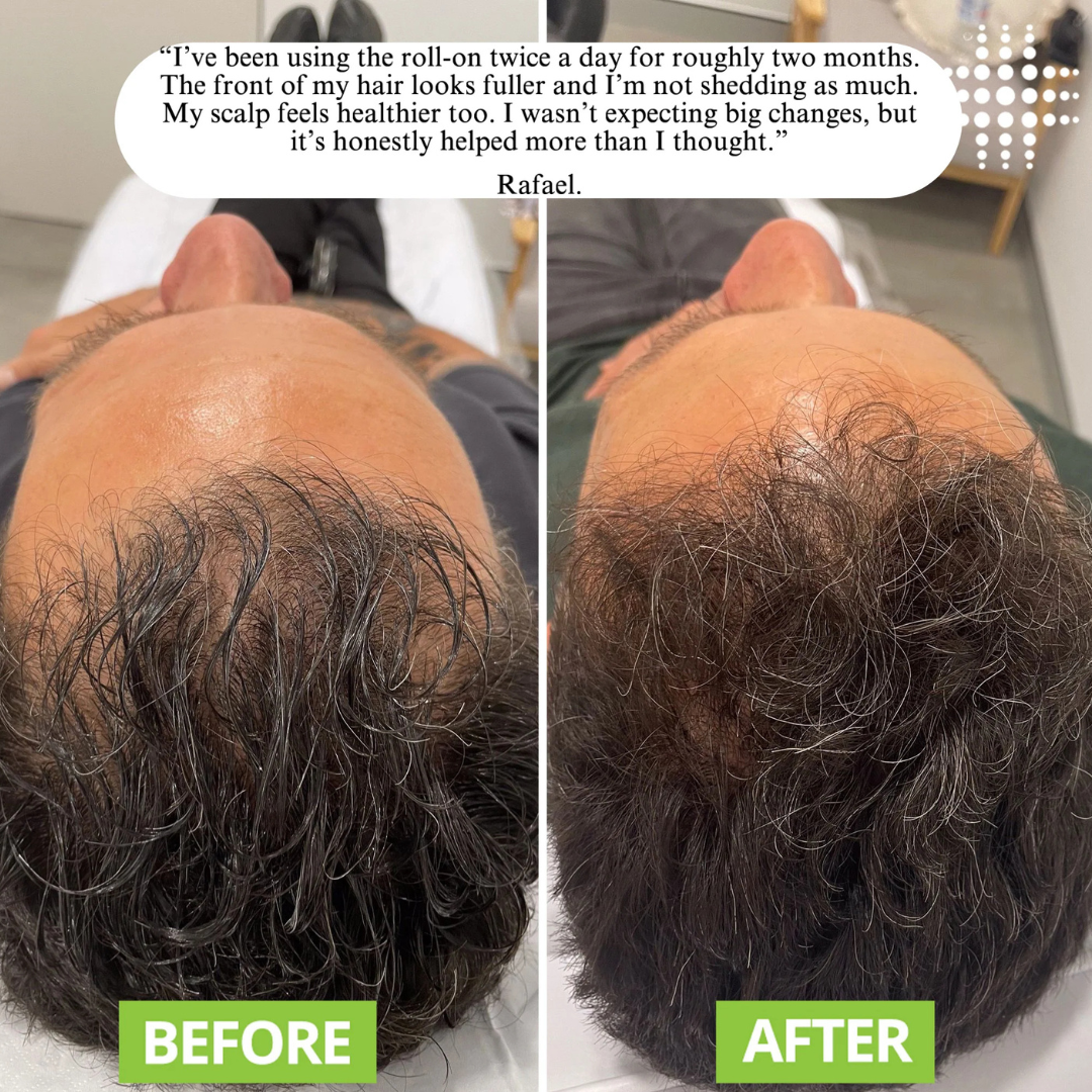 RootLuxe™ – Kopfhautserum Roll-On für kräftiges Haar