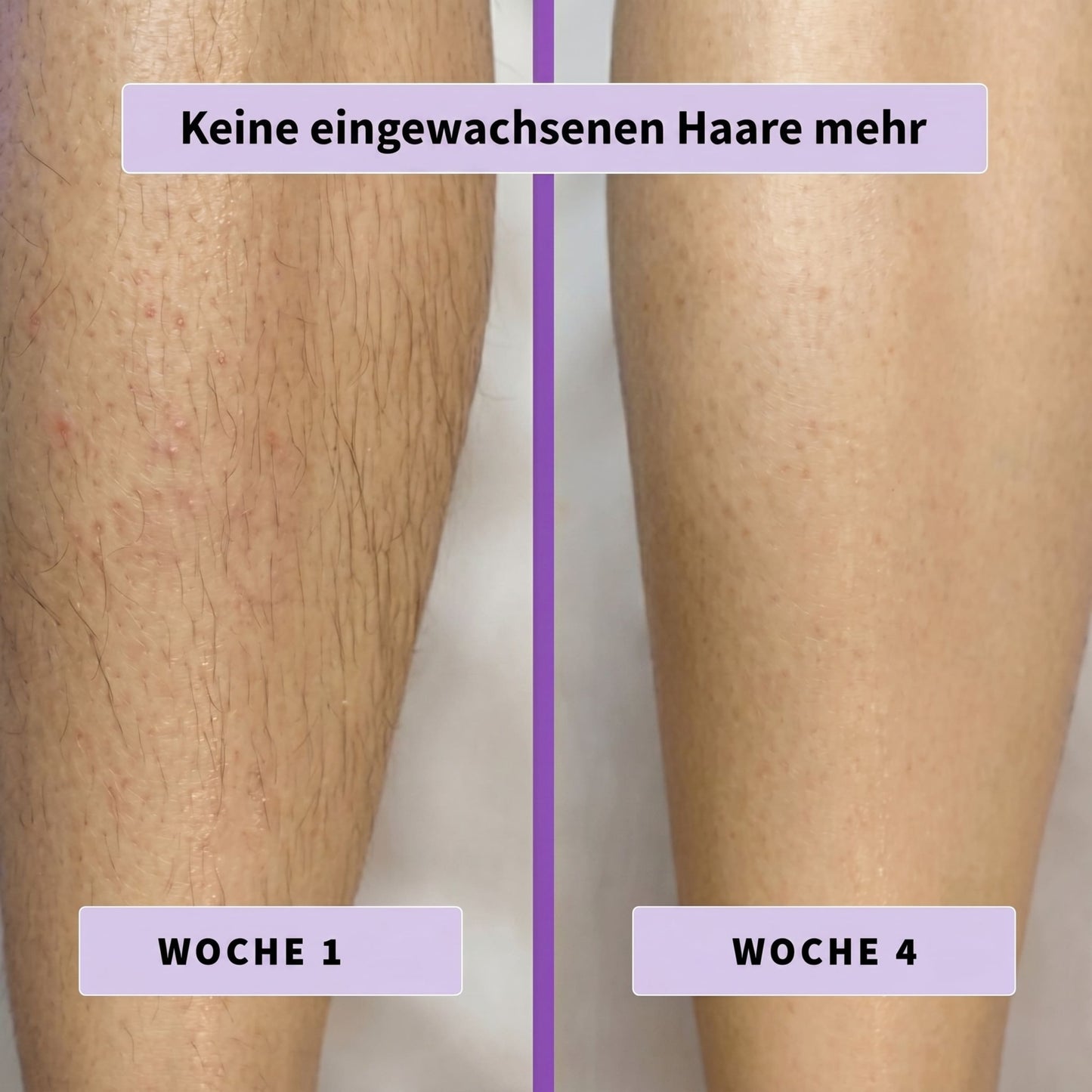 DermaLisse™ – Intensivserum für weniger nachwachsendes Körperhaar