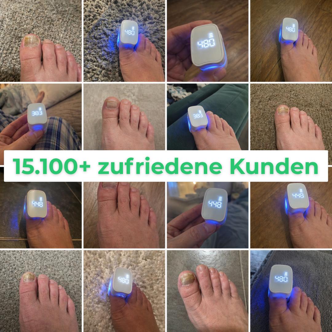 Levora | MedNail gegen jahrelangen Nagelpilz