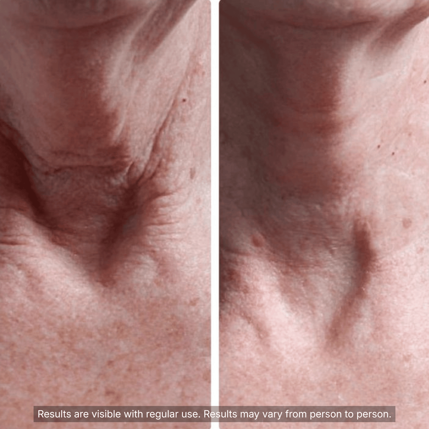 PDRN Collagen Volufiline Multi Balm