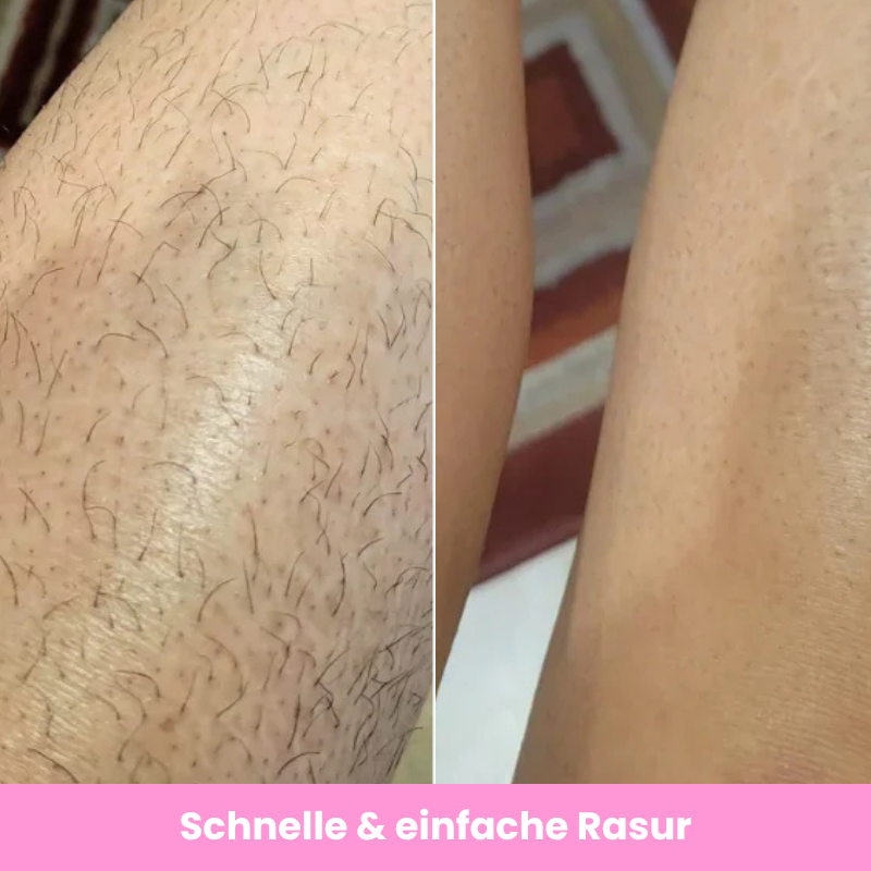 Lunelle™ Haarentfernungs-Set für glatte Haut im Sommer