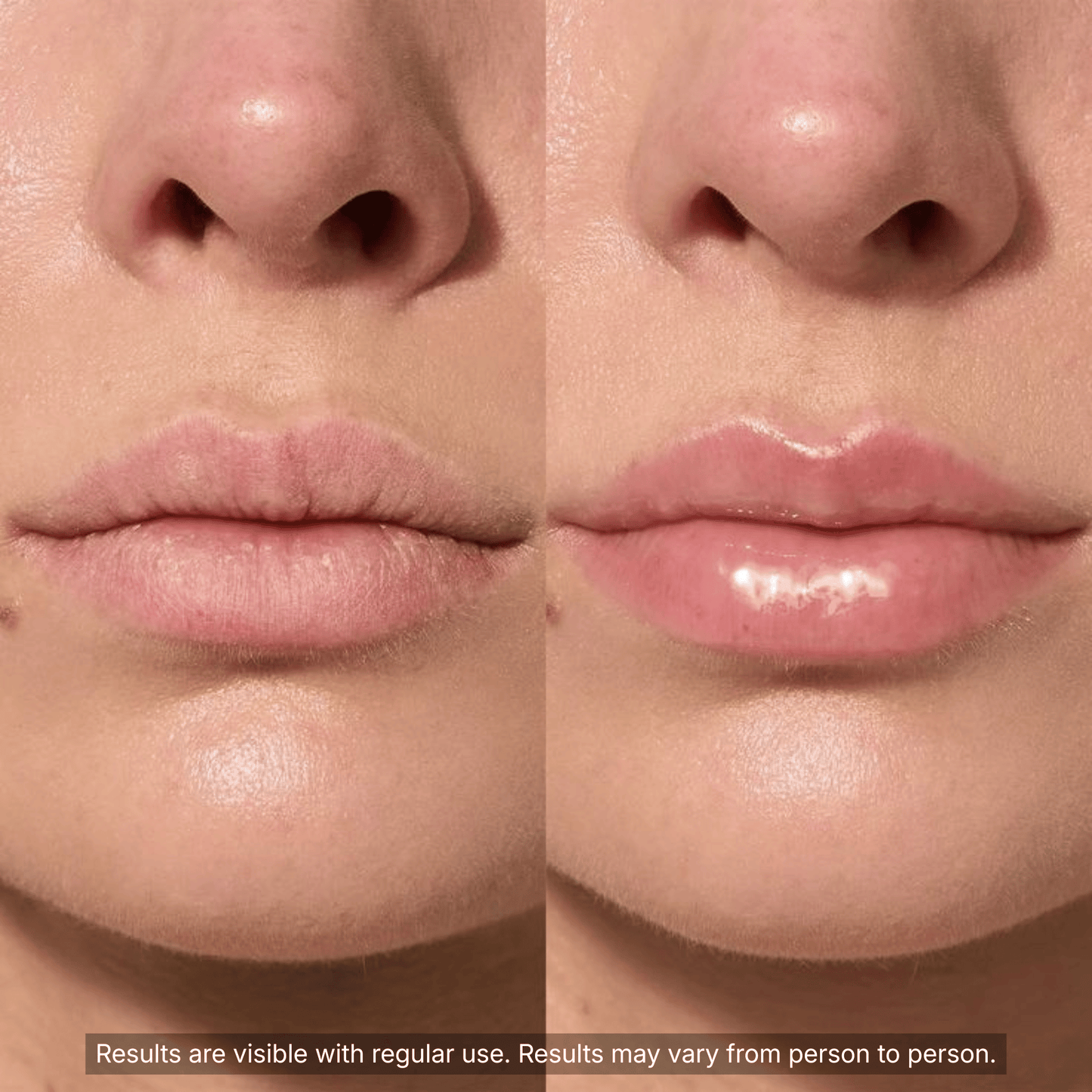 PDRN Collagen Volufiline Multi Balm