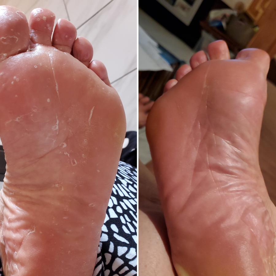 Veloma Antifungale Seife®