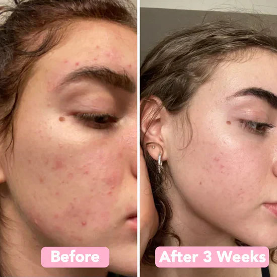 FrischAura™ Strahlende Glow-Reinigung