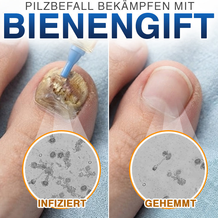 NailLuxe™ – Premium Nagelpflege mit Bienengift für schöne Nägel