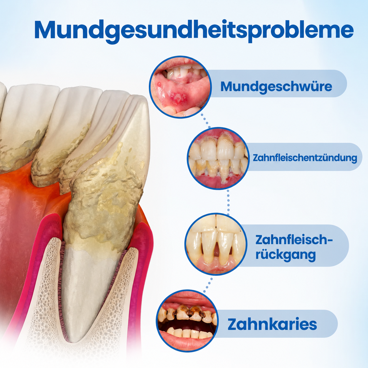 LBMLBM™ | NanoHAP Zahnschutzserum