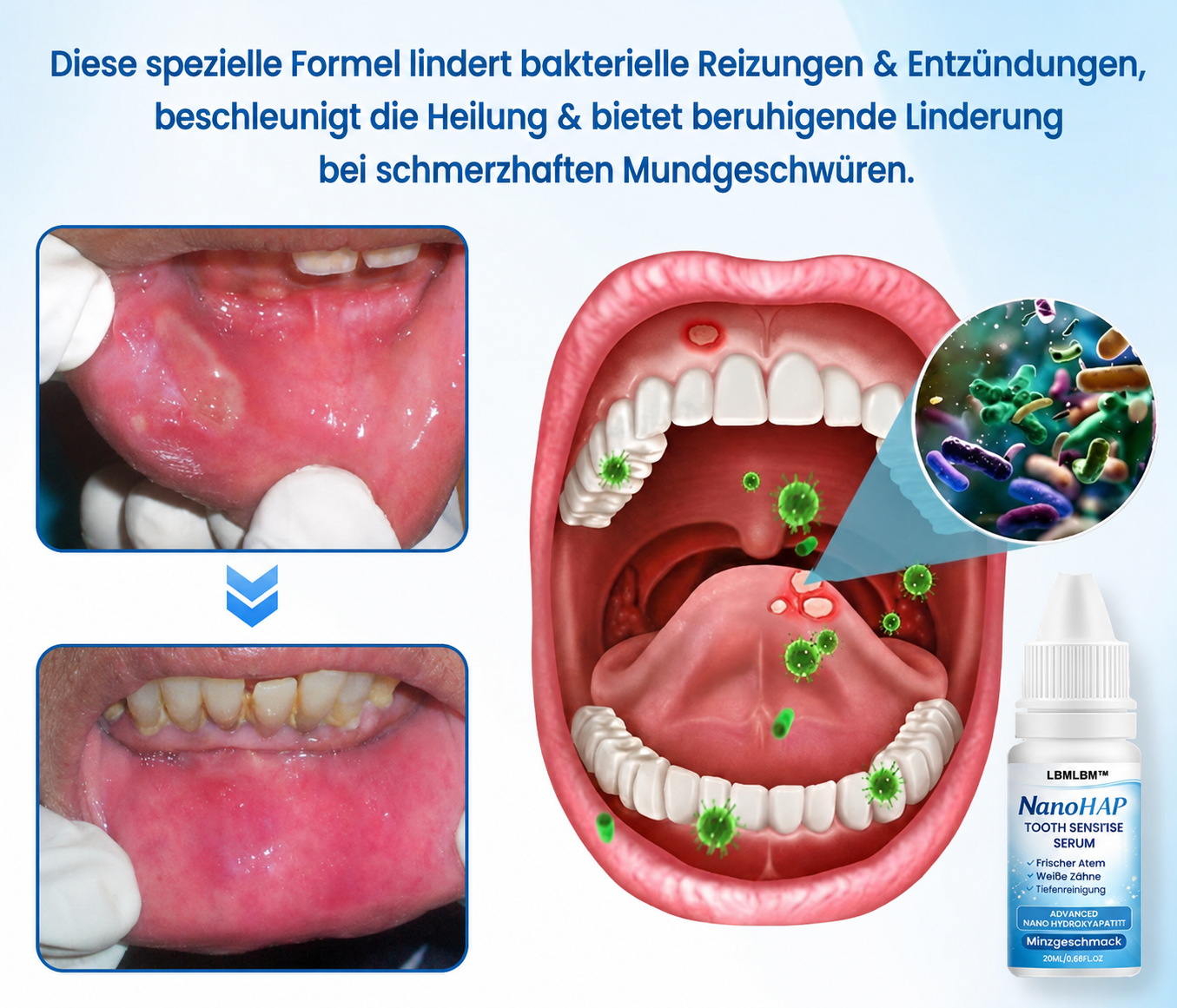 LBMLBM™ | NanoHAP Zahnschutzserum
