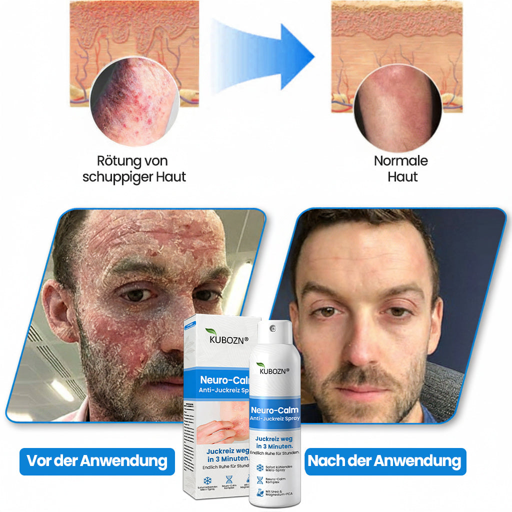DermaCalm™ – Schnelle Pflege für empfindliche, gereizte Haut | 2 Flashen Bundle