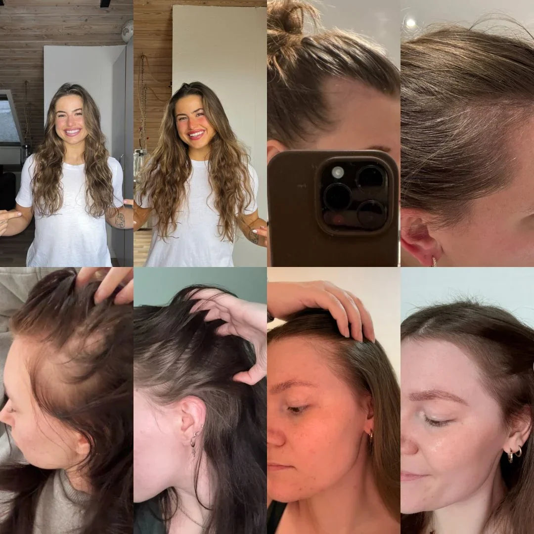 GlowRoot™ – Hair serum for stronger roots & more shine