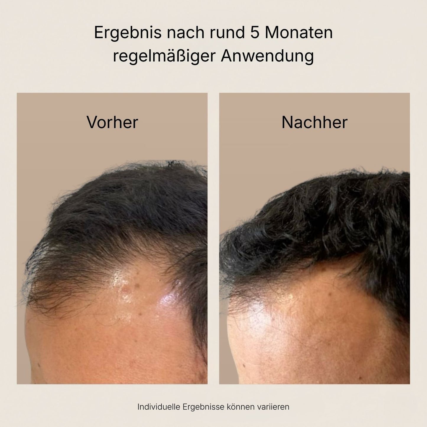Hairviva™ – Aufbauende Haarkur für geschmeidiges, glänzendes Haar