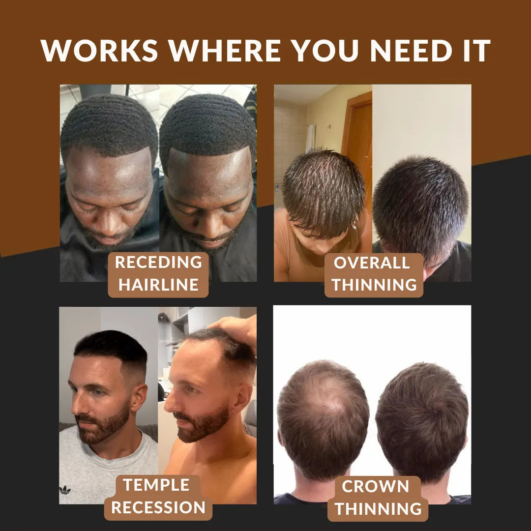 1 + 1 GRATIS | Kerablend™ Mineral-Haarverdichtung | Sofort volleres Haar in 60 Sekunden