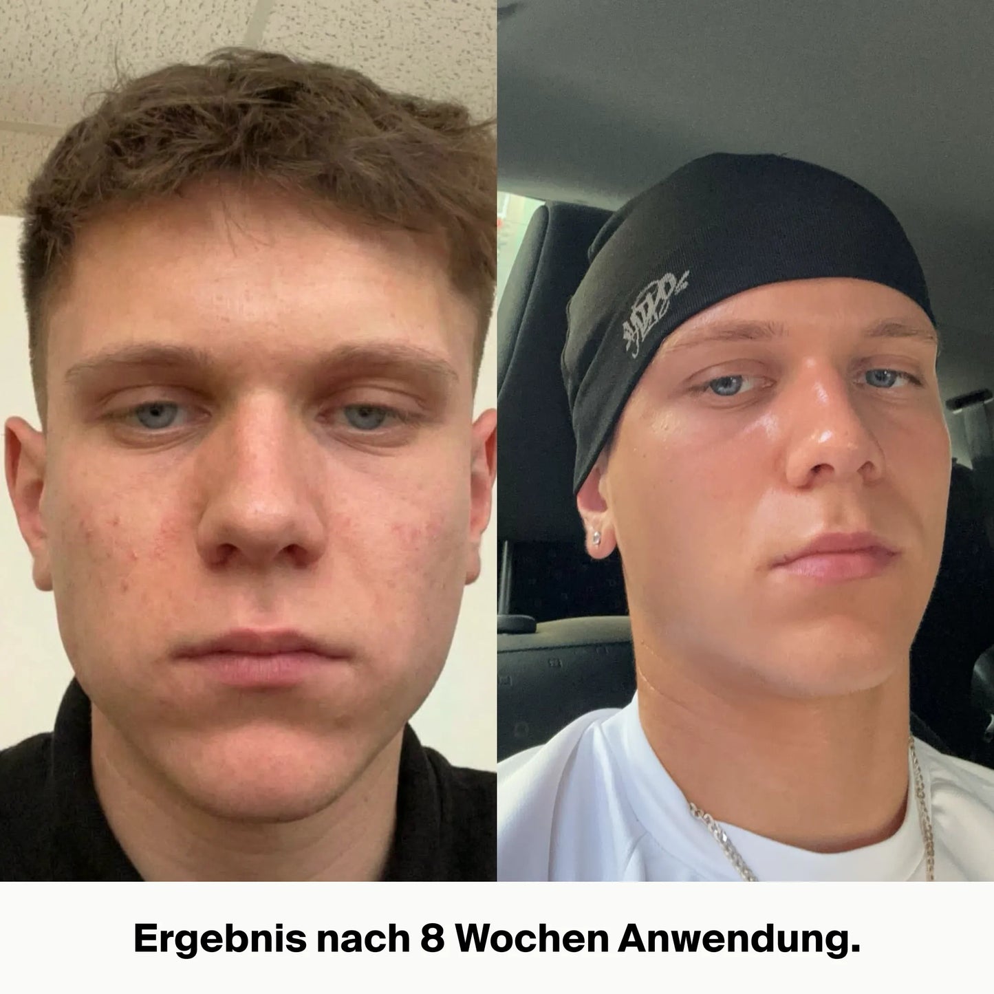 NatureGlow™ Talg-Feuchtigkeitspflege für seidig-weiche Haut