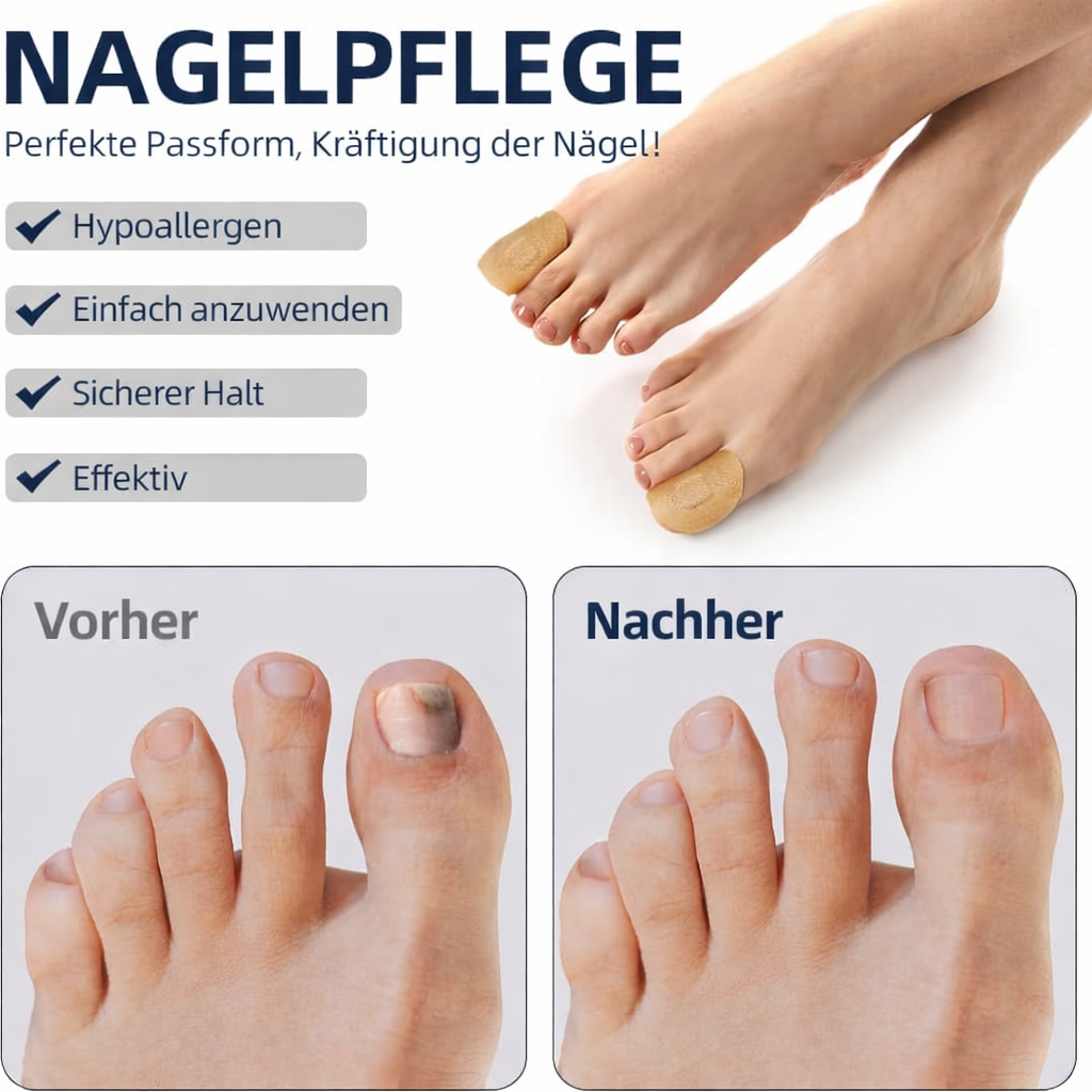 Nevela™ | Pflege-Patches für schöne Fußnägel