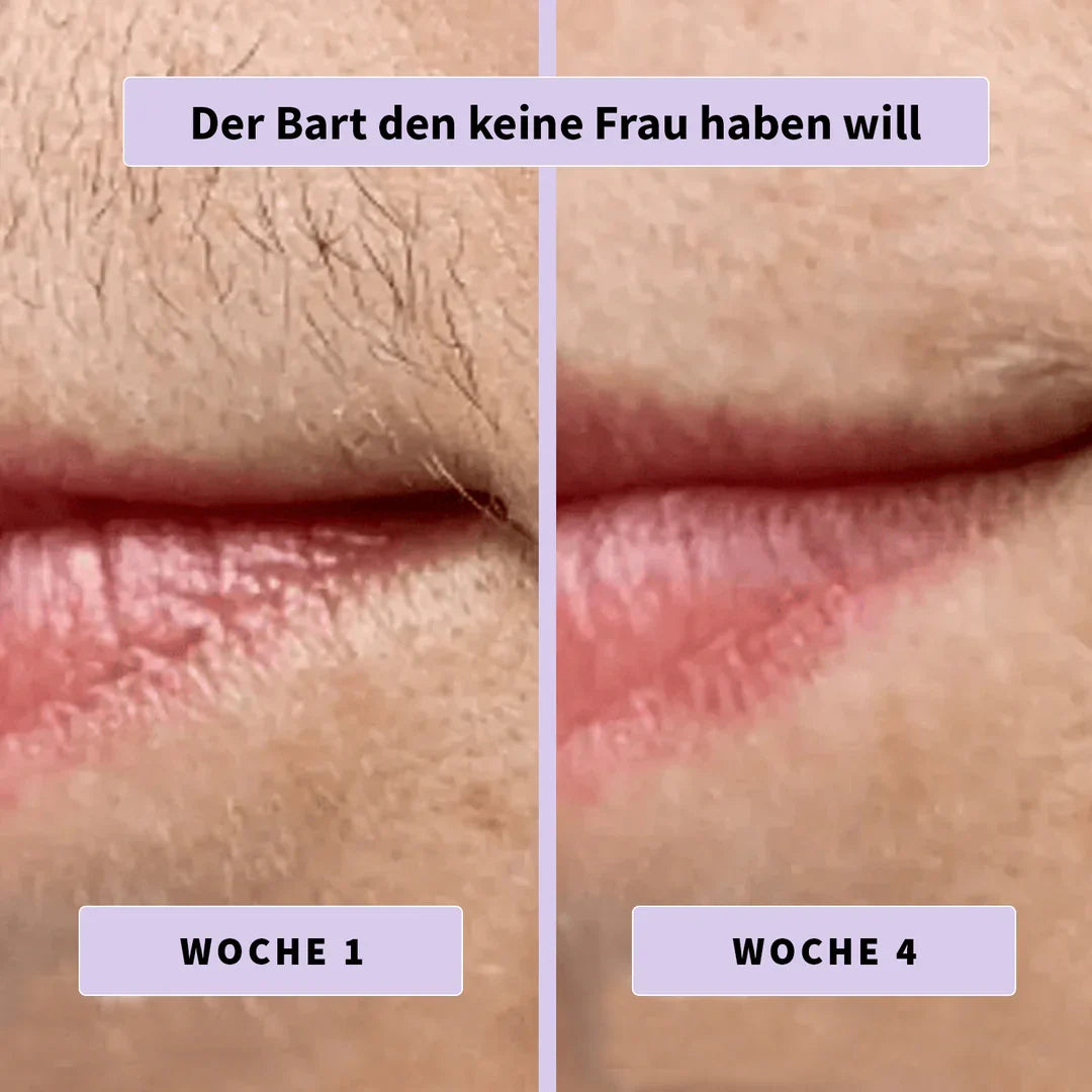 DermaLisse™ – Intensivserum für weniger nachwachsendes Körperhaar